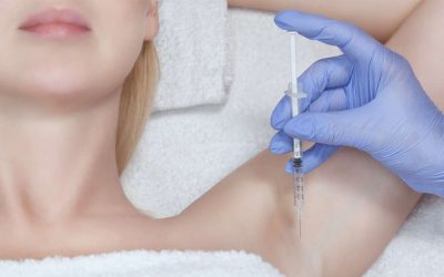 ¿Qué es la hiperhidrosis axilar?