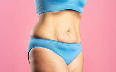 Colágeno para la Flacidez Abdominal