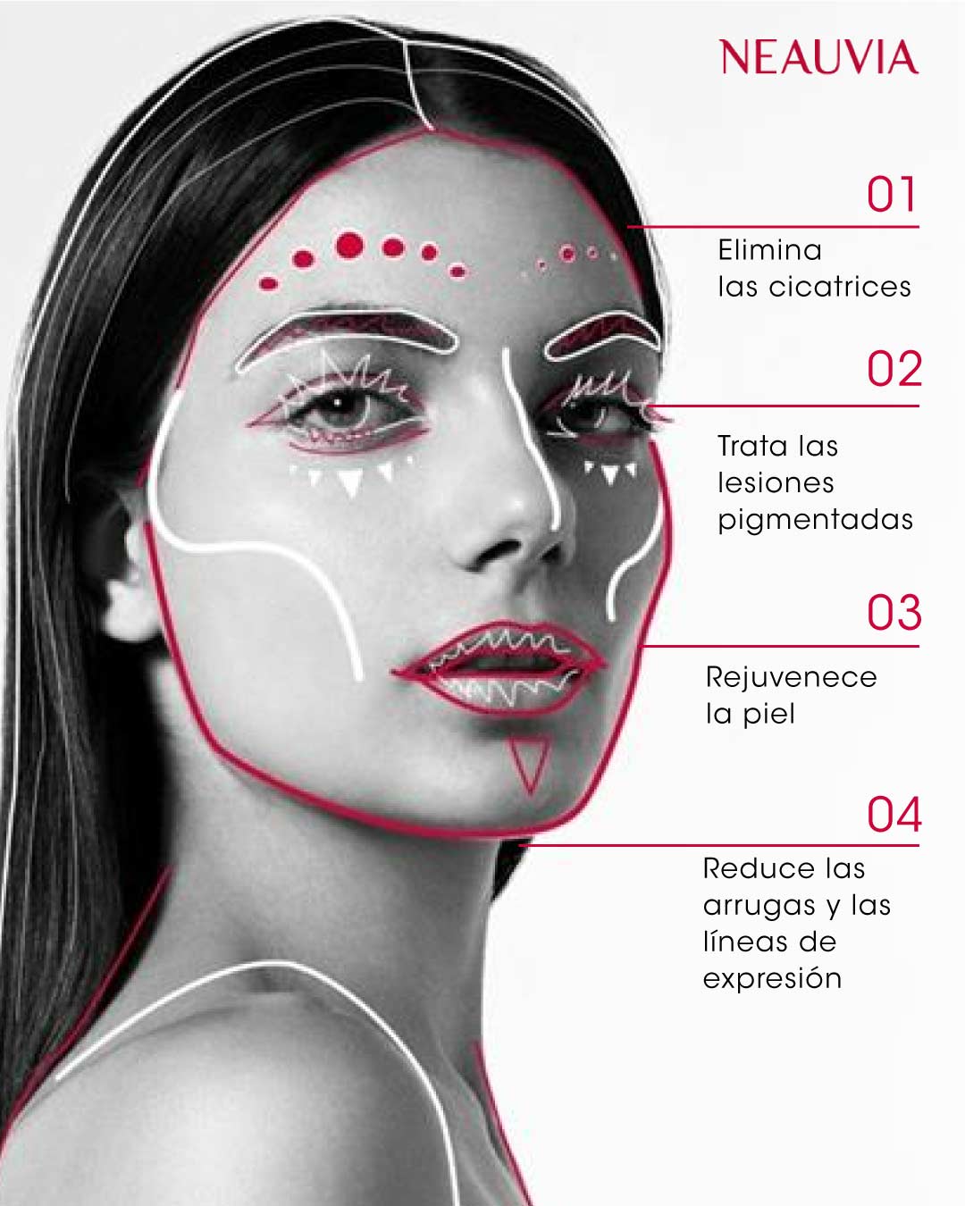 LaserMe de Neauvia</p>
<p>Rejuvenecimiento facial avanzado sin tiempos de inactividad